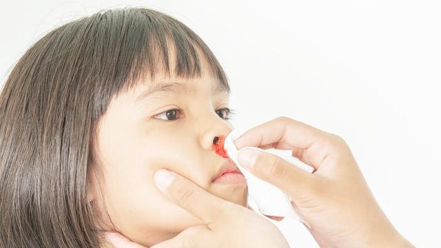 Ini Penyebab Mimisan pada Anak dan Cara Mengatasinya