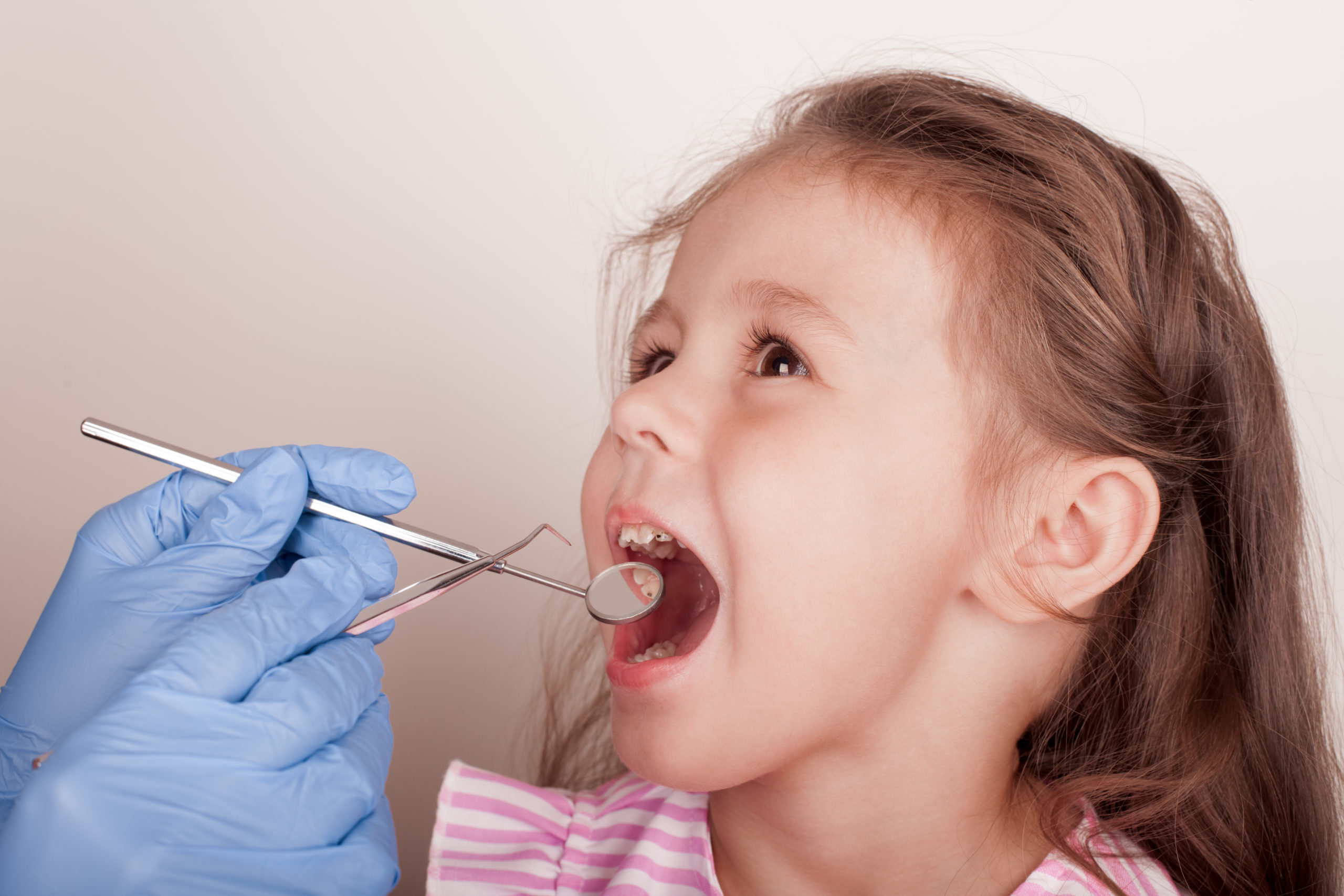 Kenali Gingivitis Pada Anak