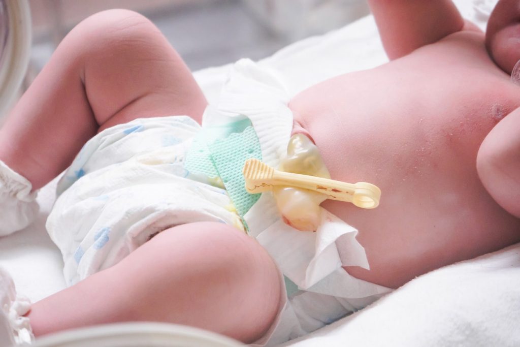 Cara Merawat Tali Pusar NewBorn