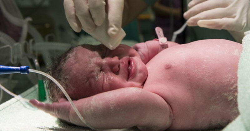 Kapan vernix caseosa akan hilang?