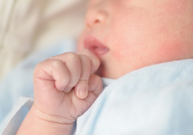 Penyebab Eksim Pada Kulit Bayi Plus Cara Mengatasinya