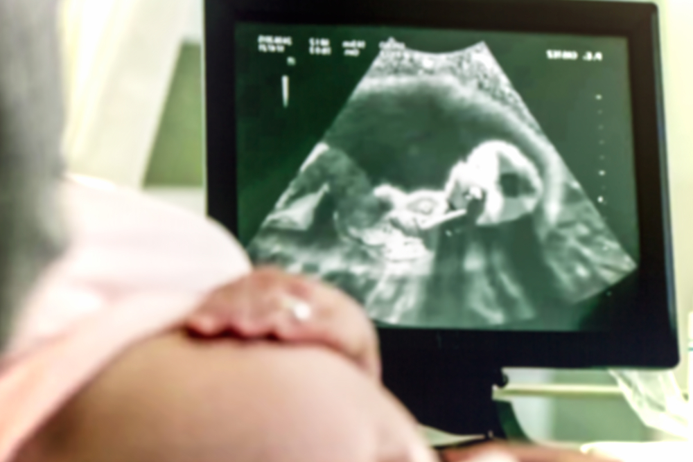 Penyebab & Gejala Preeklampsia pada Ibu Hamil