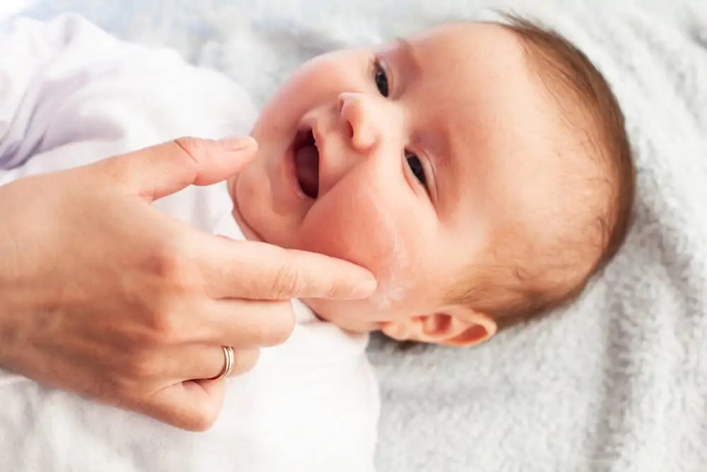 Mama Harus Tahu, Ini 5 Cara Mencegah Eksim dan alergi pada Bayi