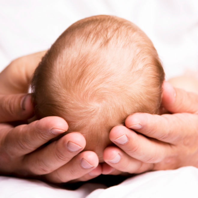 Bagaimana Menghilangkan Ketombe pada Bayi?
