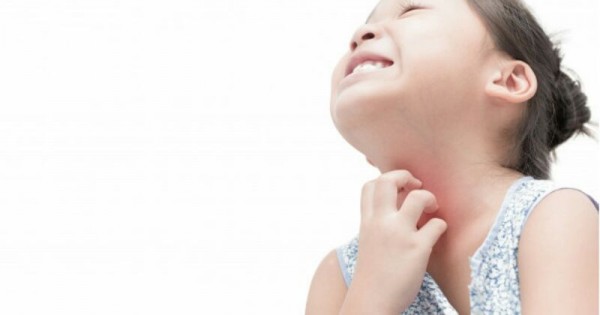 5 Cara Mengobati Gatal-gatal pada Anak Sesuai Penyebabnya