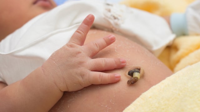 Tips Memandikan Bayi dengan Kondisi Khusus