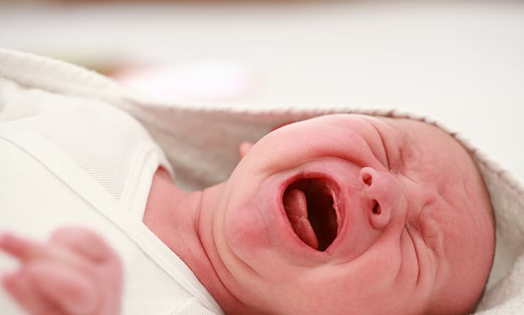 Tongue Tie and Lip Tie Pada New Born