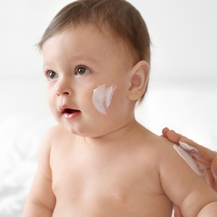 Penyakit Kulit pada Bayi yang Umum Terjadi dan Cara Pencegahannya
