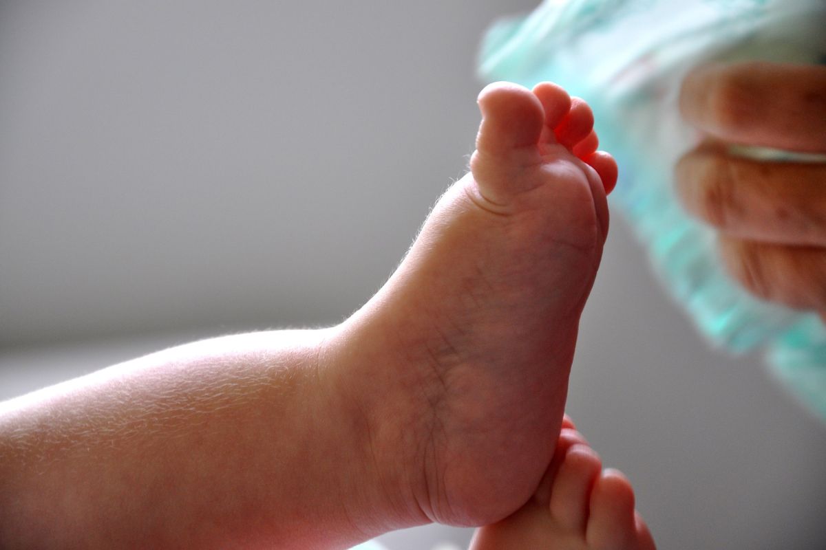 Waspadai Obesitas Pada Bayi