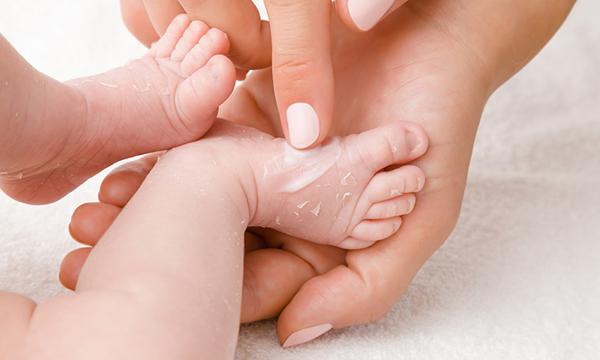 Kulit Bayi Mengelupas? Berikut Cara Mengatasinya!