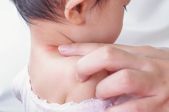 Kenali Gejala DBD pada Bayi! Berikut Cara Pengobatannya