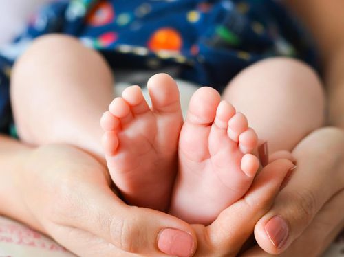 Kenali, Berbagai Penyebab Kasus Clubfoot pada Bayi