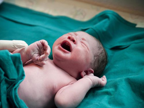 Waspada, Hipotiroid Kongenital Bisa Pengaruhi IQ Bayi