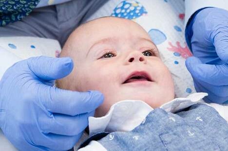 Waspadai Dermatitis Seboroik, Kondisi Kulit Kering dan Berkerak pada Bayi