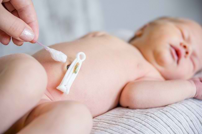 5 Cara Menjaga Kebersihan dan Merawat Tali Pusar Bayi