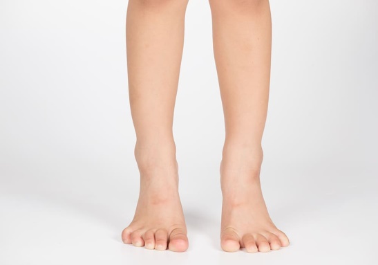 Penyebab Kaki O pada Anak, Ciri – Ciri, dan Cara Mencegahnya