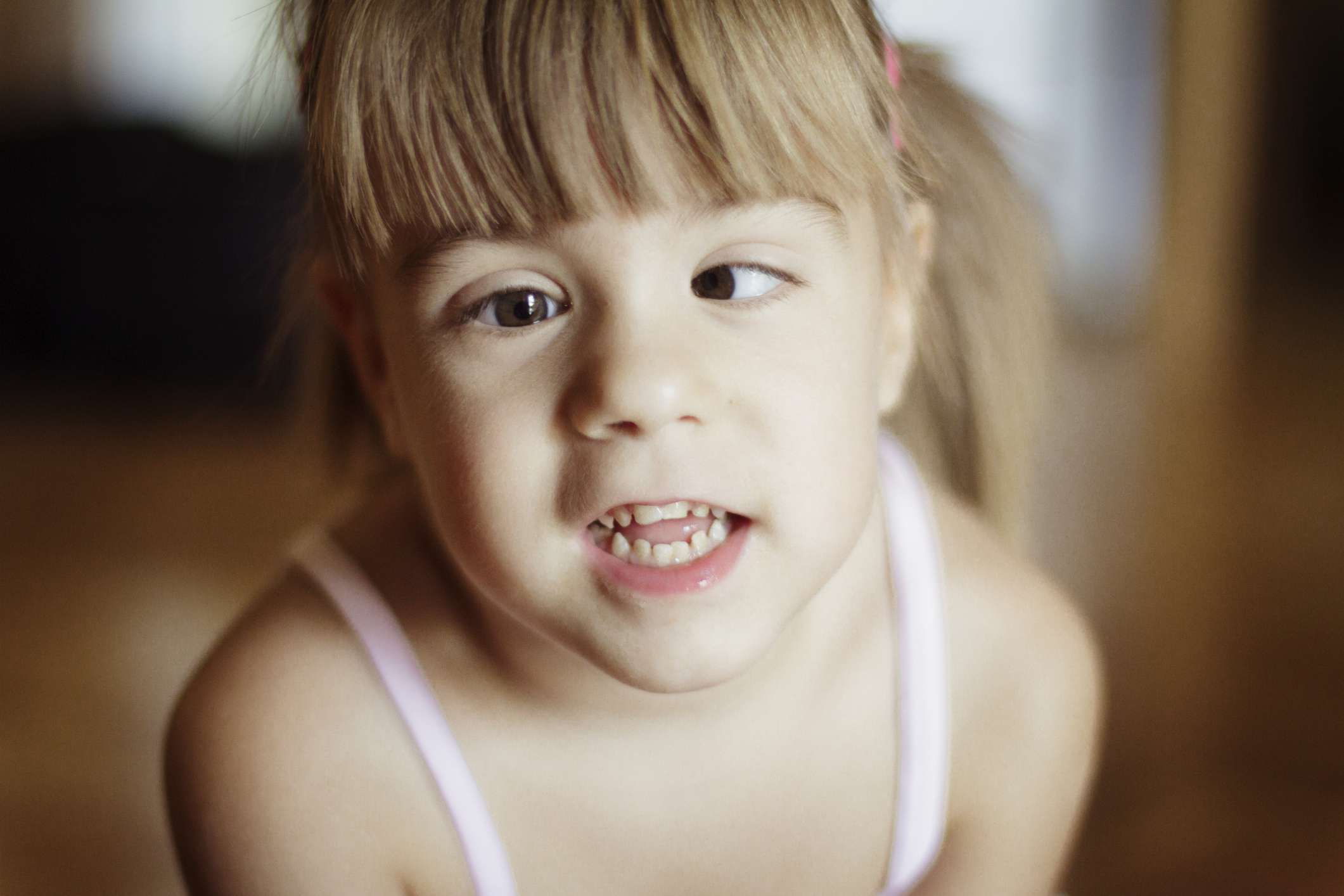 Tips Mengatasi Lazy Eye Syndrome Pada Anak