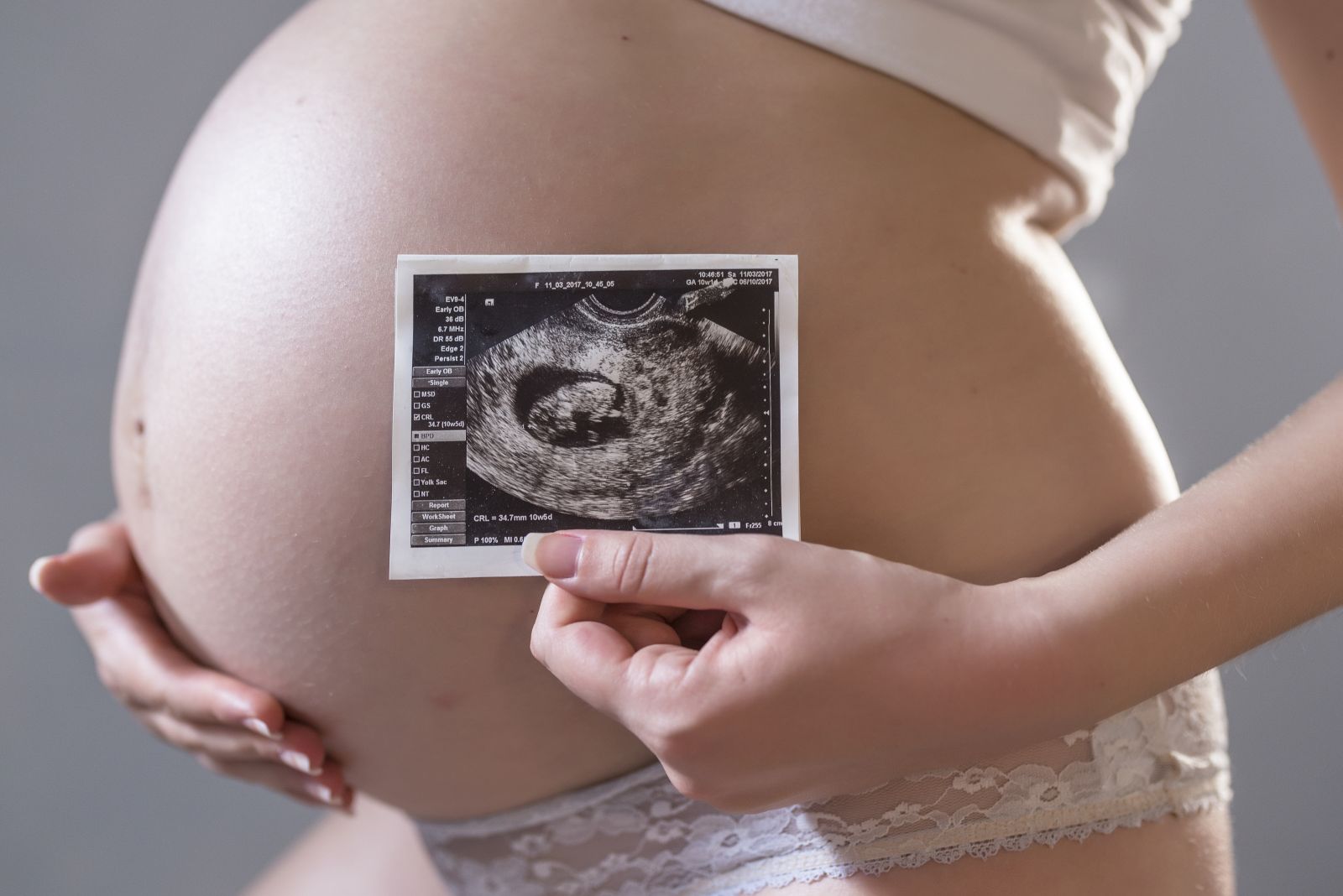 Mengenal Plasenta Anterior pada Kehamilan